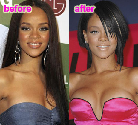  Rihanna had opted for plastic surgery and gotten breast implants