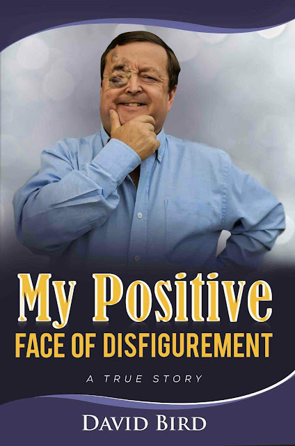 My Positive Face of Disfigurement - Book Cover Image pic