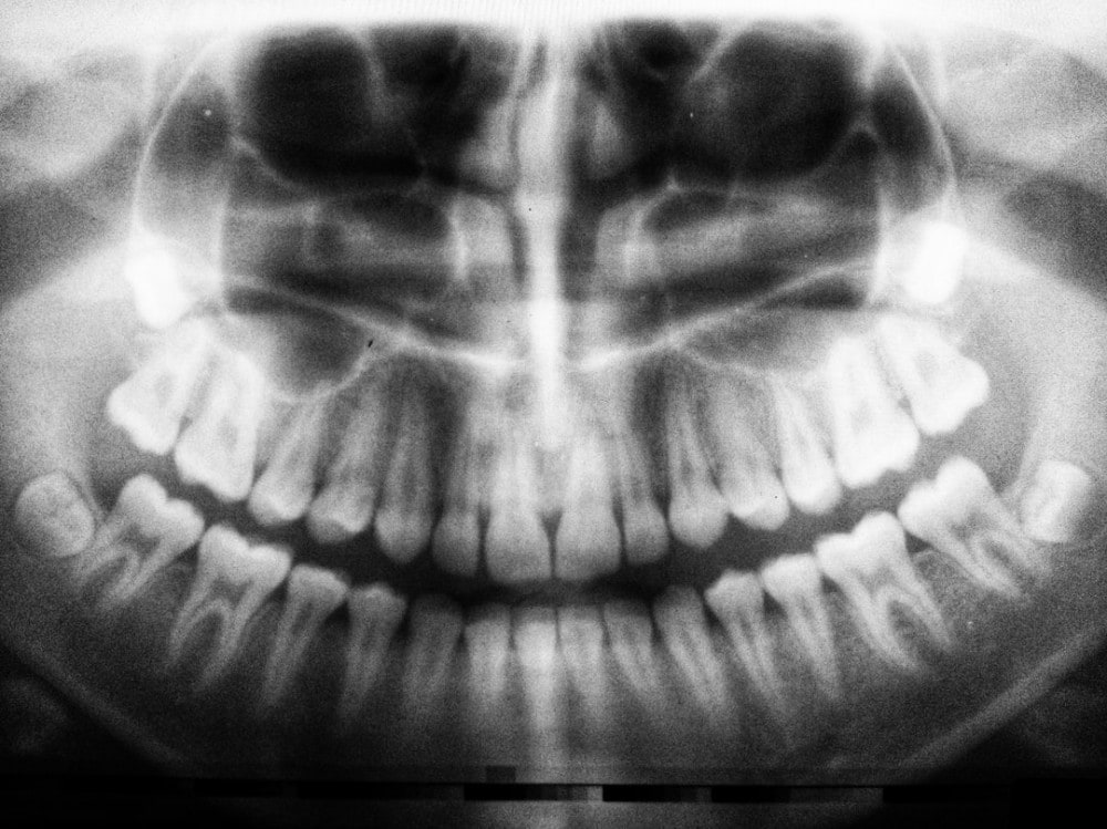 skeleton with cigarette in between its teeth