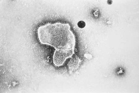 Electron micrograph revealing the morphological traits of the RSV