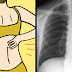 8 Signs Of Lung Cancer Every Woman Needs To Know