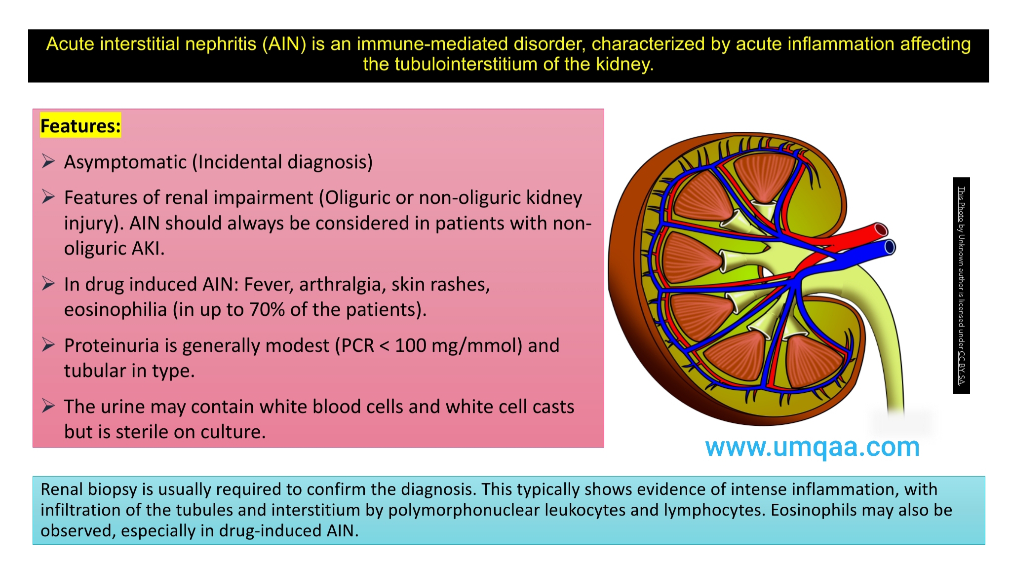 acute interstitial nephritis