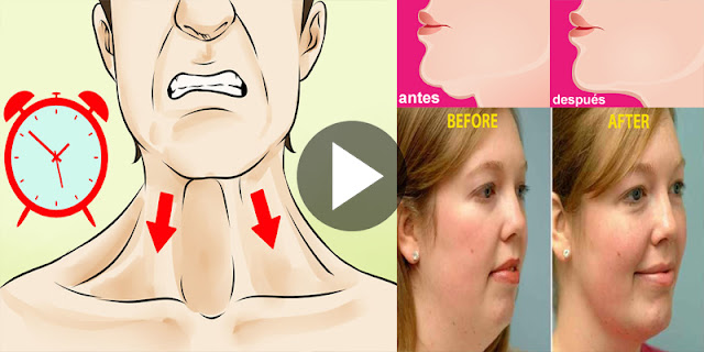 Simple Steps That Will Remove Your Double Chin