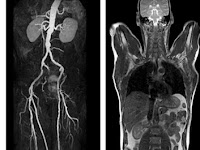 Mri Merupakan Alat Dalam Ilmu Kedokteran Yang Memanfaatkan Prinsip