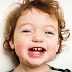 Dấu hiệu viêm chân răng trẻ em