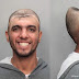 Man Missing the top half of his Head Appears in a Mugshot