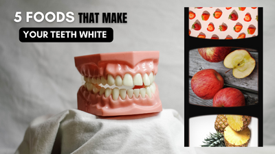 5 Foods that make your teeth White