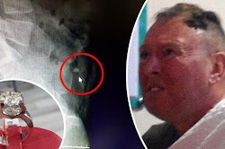  Ένα δαχτυλίδι 2,5 καρατιών από κοσμηματοπωλείο στην Τουρκία επιχείρησε να κλέψει ένας Ιρλανδός τουρίστας, αλλά η προσπάθειά του αποδείχθηκε...