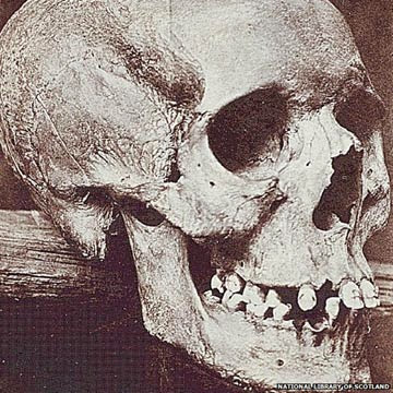 skull-of-Lilias-Adie