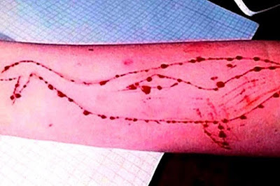 First Blue Whale case in Bengaluru and Blue Whale Survivor In Puducherry, 22, Shares Terrifying Details