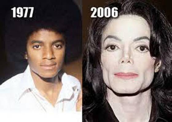 michael jackson before and after