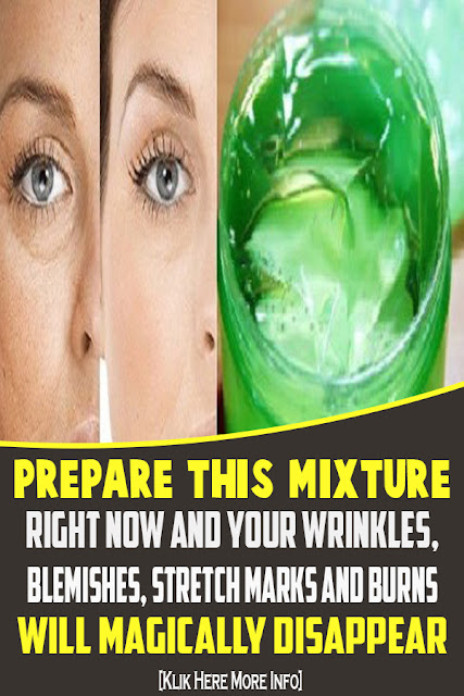 Prepare This Mixture Right Now And Your Wrinkles