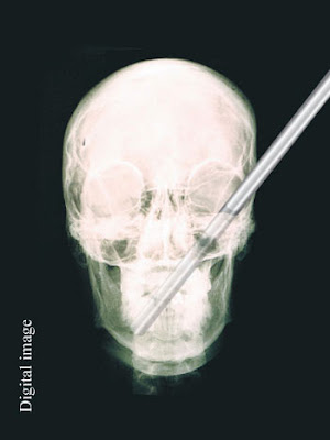 shafique el fahkri x ray image2 Hasil Foto X ray yang Ekstrim