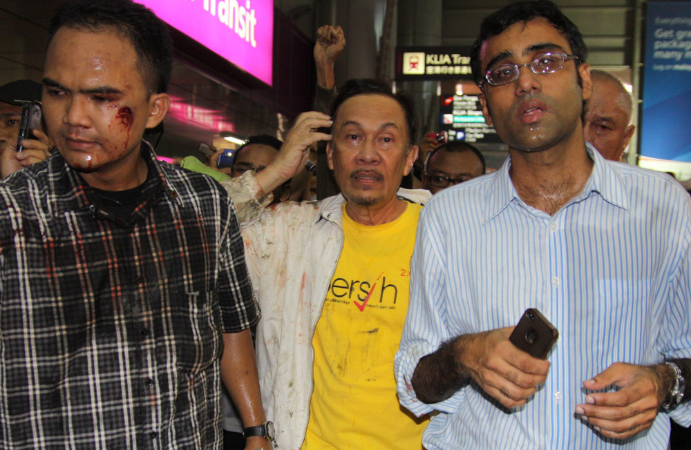 Apa Tujuan Anwar diserang di KL Sentral underpass?