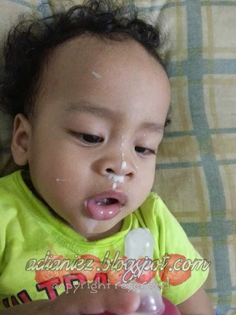 Ubat Selsema Titik Hidung - Frisure w