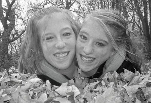 conjoined twins abby and brittany. Abby And Brittany Hensel: