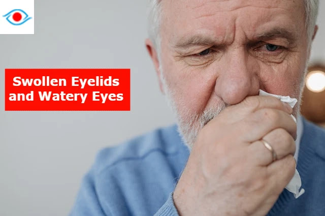 swollen-eyelid-and-watery-eyes