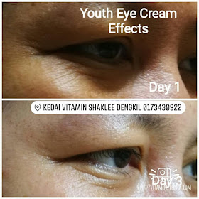 Youth Eye Treatment