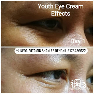 Youth Eye Treatment