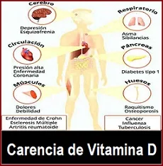 Alteraciones corporales provocadas por la falta de vitamina D