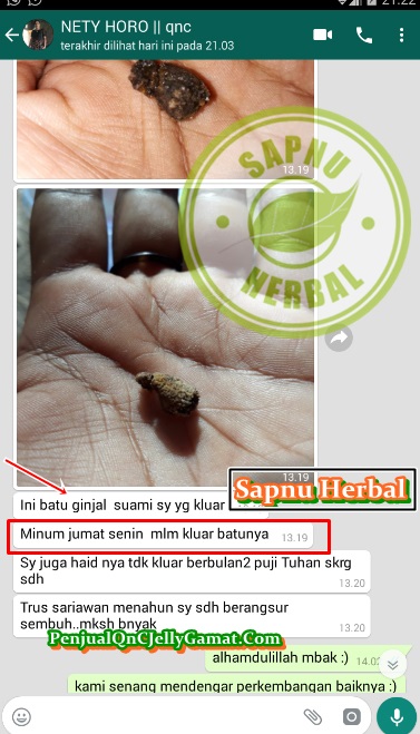 Biaya Operasi Kencing Batu dan Pengobatan Alternatifnya ~ TESTIMONI QNC JELLY GAMAT