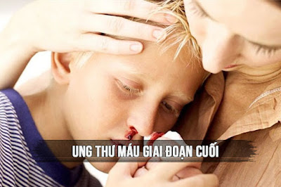 Ung thư máu giai đoạn cuối