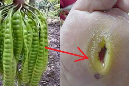 TOLONG SAMPAIKAN DI ORANG TUA ANDA, KULIT PETAI MULAI SEKARANG JANGAN DI BUANG!!! SANGAT AMPUH UNTUK MENGOBATI DIABETES..BEGINI CARA MERAMUNYA....