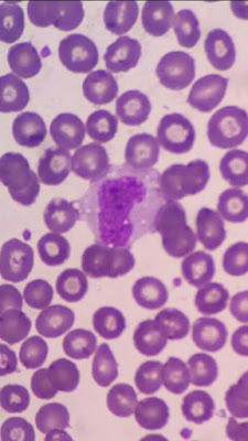 Imagen de un Monocitos - Valores Normales de Leucocitos