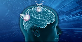 Sistema de interfaz neuronal de DARPA