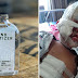 Muka budak melecur selepas botol hand sanitizer disambar api