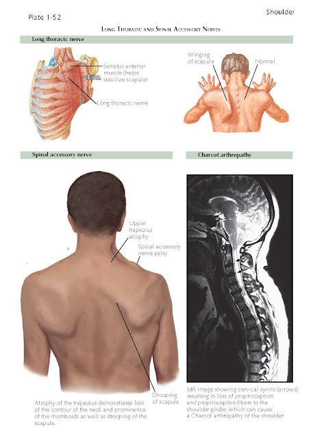 Neurologic Conditions Of The Shoulder