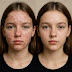 Essential Post-Skincare Care Tips for Radiant and Healthy Skin"