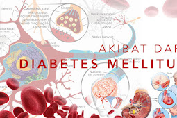 Jual Obat Herbal Diabetes Ampuh Di Bantul | WA : 0822-3442-9202