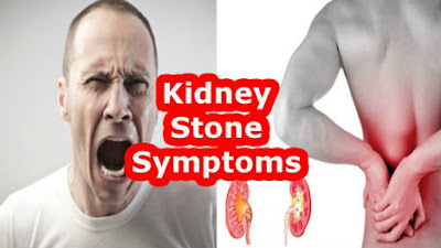 गुर्दे की पथरी: लक्षण - Kidney Stones: Symptoms | gurde kee patharee: lakshan, किडनी स्टोन के लक्षण kidney stone ke lakshan, किडनी स्टोन के लक्षण इन हिंदी, kidney stone ke lakshan in hindi