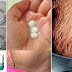 How To Get Rid Of Stretch Marks Very Fast By Using Aspirin!