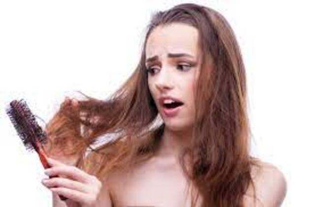 10 Natural Remedies to Stop Hair Fall