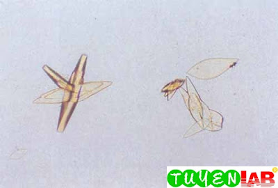 Uric acid crystals (100x)