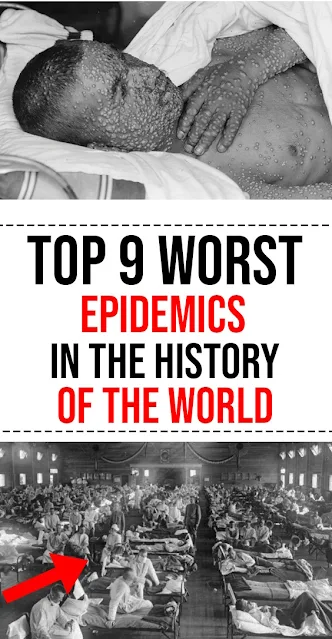 Top 9 Worst Epidemics In The History Of The World