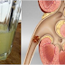 ONLY HALF A CUP OF THIS DRINK WILL COMPLETELY DISSOLVE AND FLUSH THE KIDNEY STONES FROM YOUR BODY