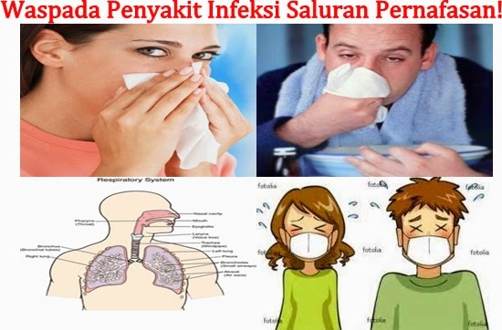 Pengobatan Terbaik Untuk Infeksi Saluran Pernafasan