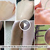 DIY - How to Lighten Skin Scars Naturally - Tan, Scars, Elbows, Knees, Underarms And Knuckles