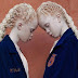  Lara y Mara, las gemelas albinas que muestran la belleza de la diversidad