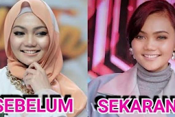 RINA NOSE, ‘HIDUNG PESEK’ DALAM SOROTAN.