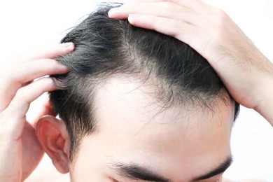 How to dandruff remove permanently and stop hair fall immediately ?