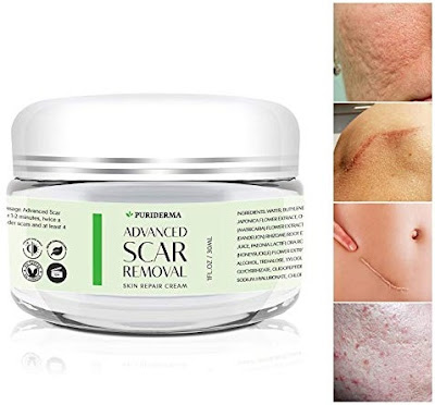 scar removal cream