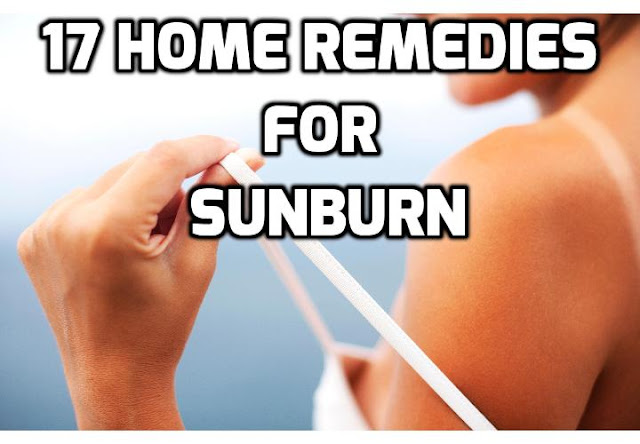 The best thing to do is prevent sunburn, but even when you do try to protect yourself, you may end up burned anyways. To avoid peeling and get rid of the redness and stinging, here are 17 sunburn treatments that are simple, fast, and effective.