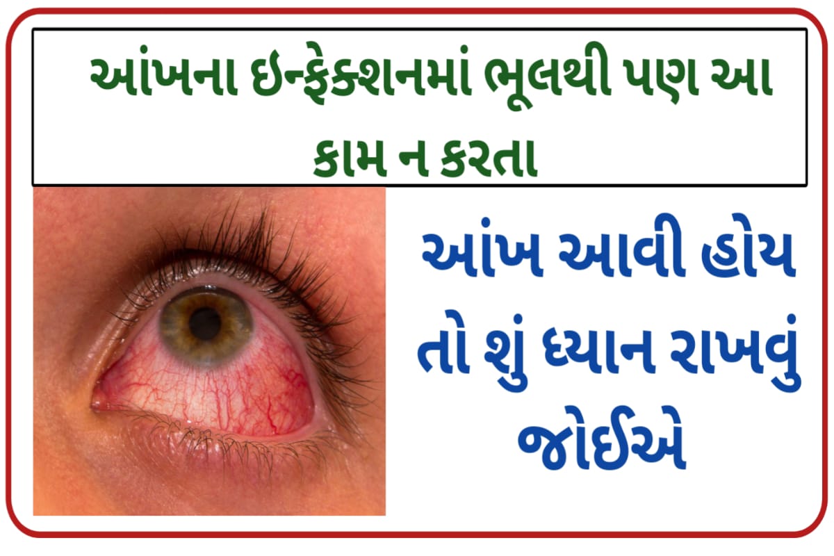 Eye Infections what not to do if you have an eye infection