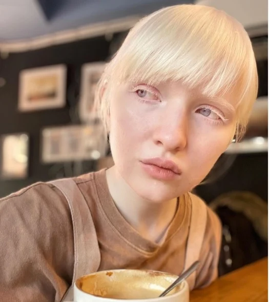 model albino rusia kiker chan