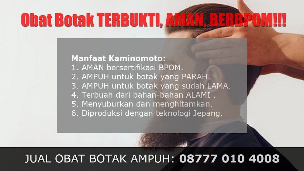 OBAT BOTAK WANITA<br/>Melonguane<br/>