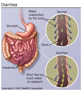 Nursing Care Plan for Diarrhea